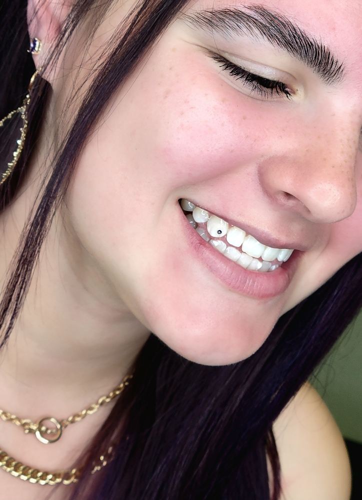 Teeth